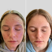 Load image into Gallery viewer, Omnilux Clear