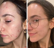 Load image into Gallery viewer, Omnilux Clear