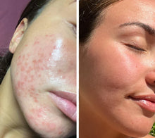 Load image into Gallery viewer, Omnilux Clear