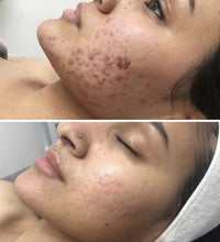 Load image into Gallery viewer, Omnilux Clear