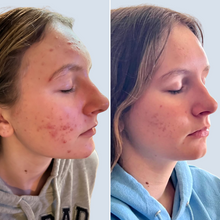 Load image into Gallery viewer, Omnilux Clear