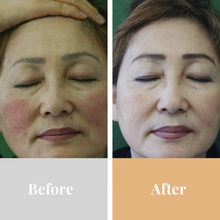 Load image into Gallery viewer, Omnilux Contour Face (Pre-order for November)