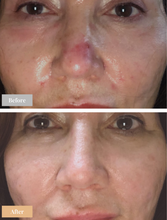 Load image into Gallery viewer, Omnilux Contour Face (Pre-order for November)