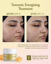 Load image into Gallery viewer, Turmeric Energizing Treatment
