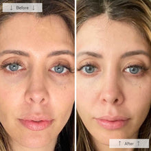 Load image into Gallery viewer, Omnilux Contour Face
